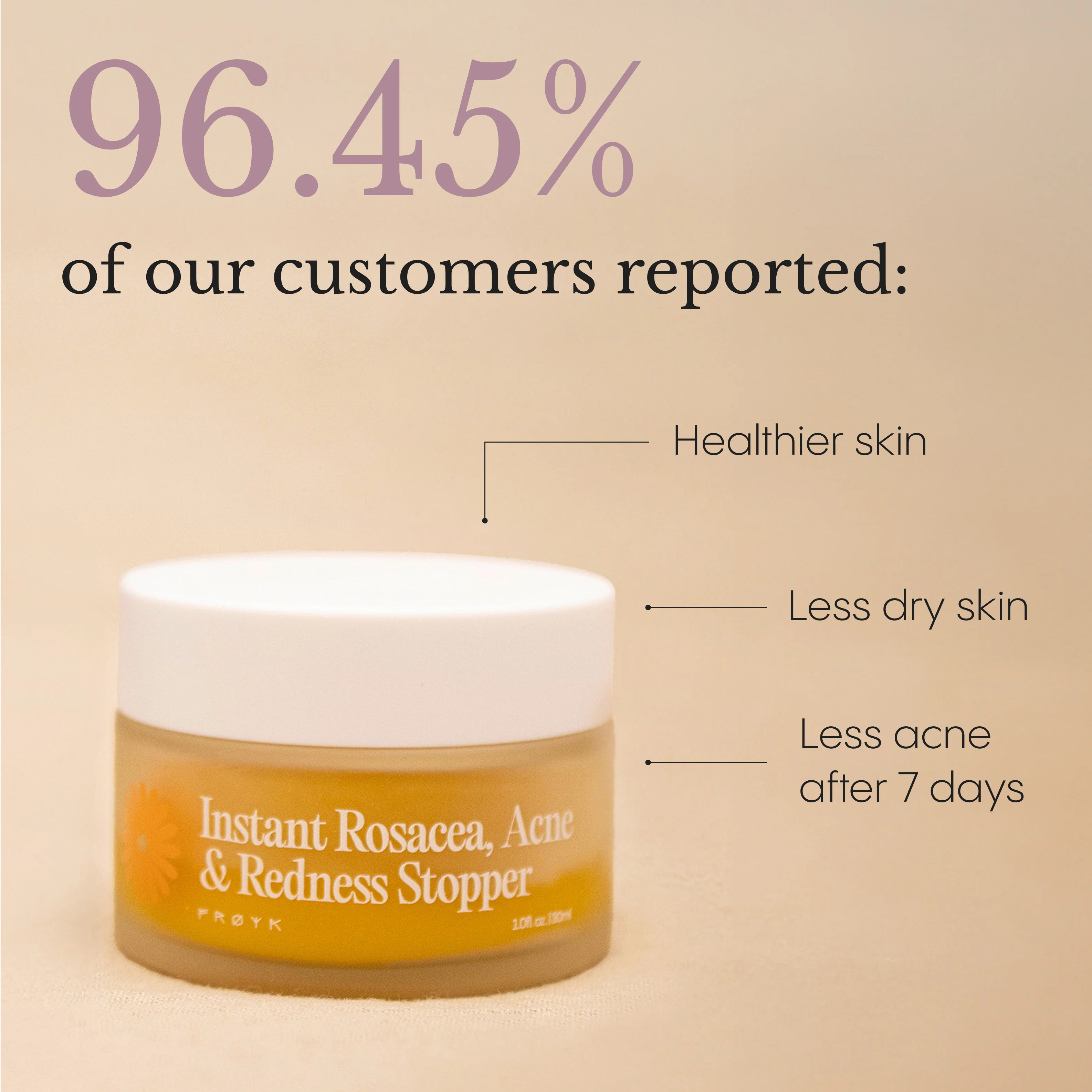 Instant Rosacea, Acne & Redness Stopper - Image 4