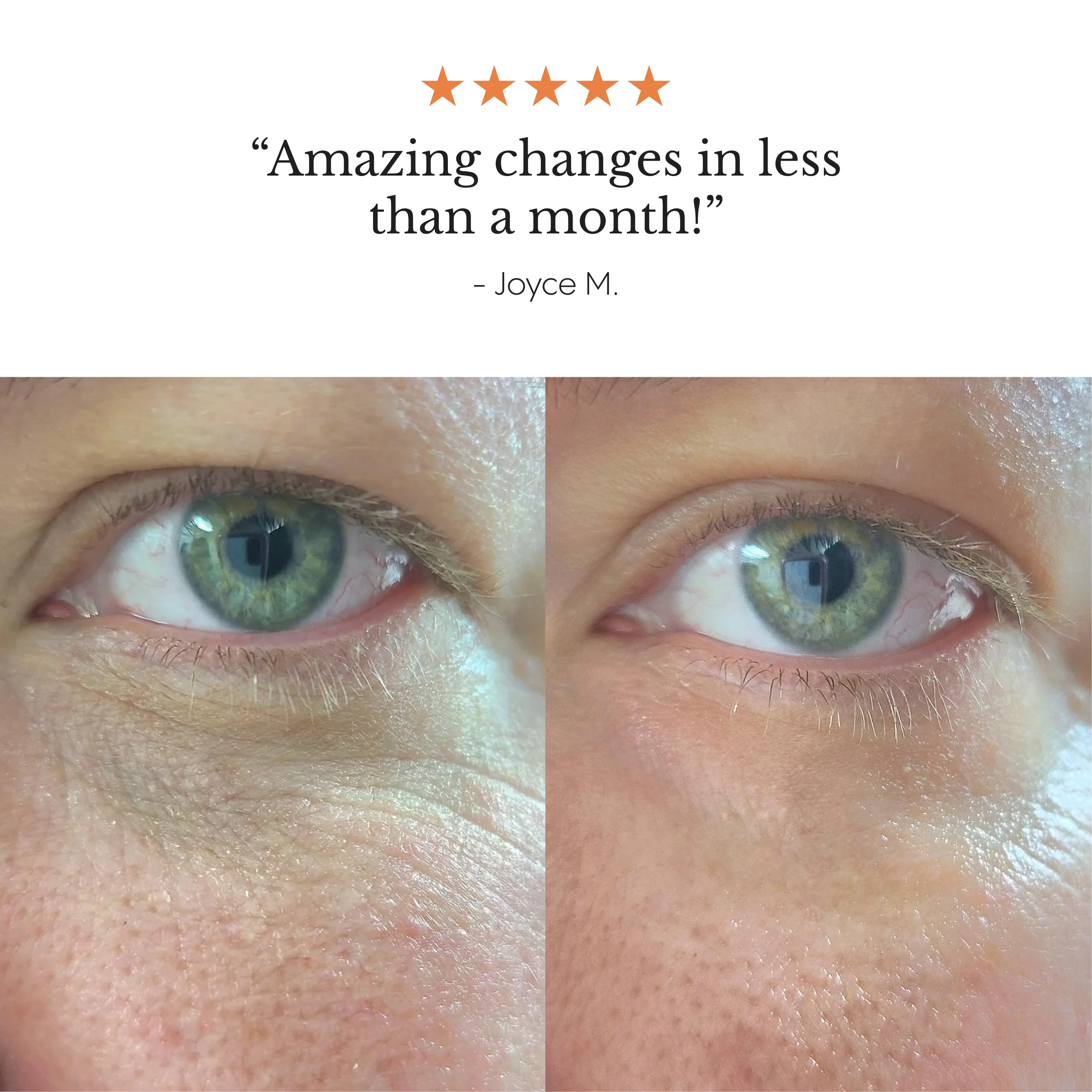 Hyper Potent Dark Circles & Bag Eye Balm - Image 5